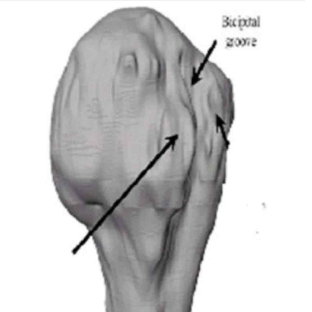 <p>cat #3 / slit-like furrow / bicipital groove in humerus</p>