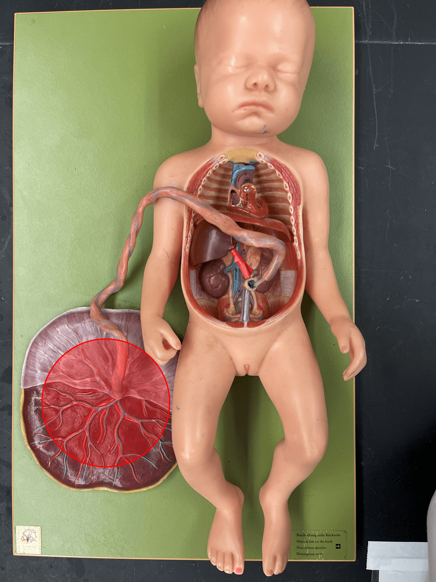 • Organ that delivers nutrients and oxygen to the fetus and removes wastes from the fetus.

• Connected to the fetus by the umbilical cord.

• Contains chorionic villi from the fetus and intervillous spaces from the mother.