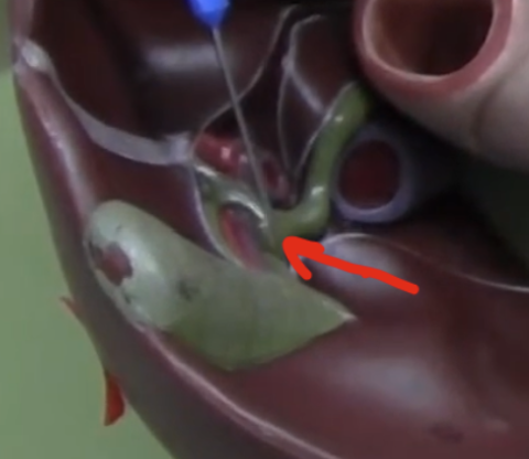 <p>(bringing bile in/out of the Gallbladder) </p>