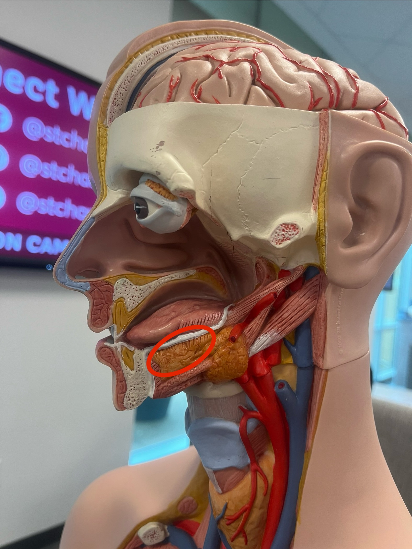 <p>what gland is this?</p>