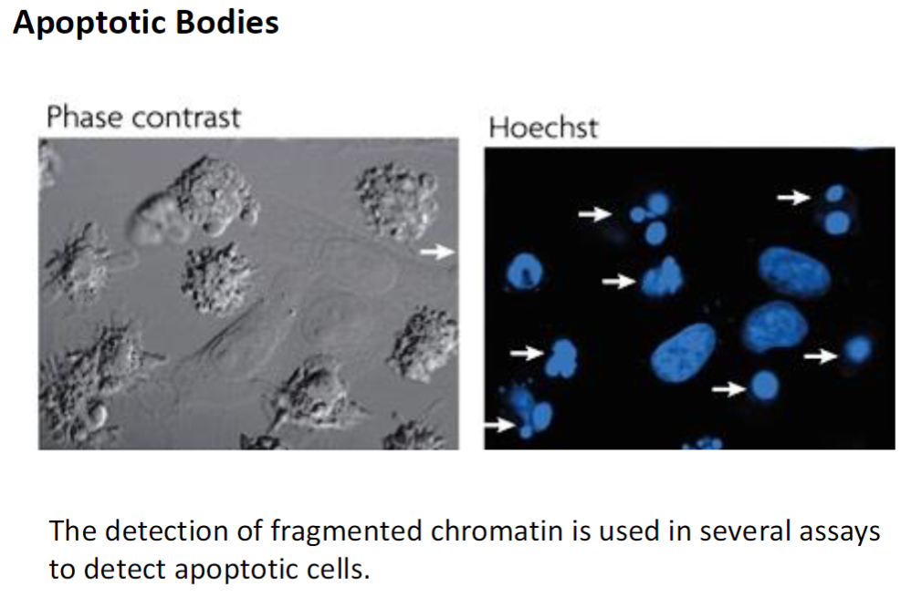 <p><strong>Assay Principle</strong><br> Fragmented chromatin can be detected using various laboratory assays</p><p><strong>Apoptotic Bodies</strong><br> Small vesicles containing degraded chromatin and cellular contents<br> Formed during apoptosis and can be recognized and engulfed by phagocytic cells</p>