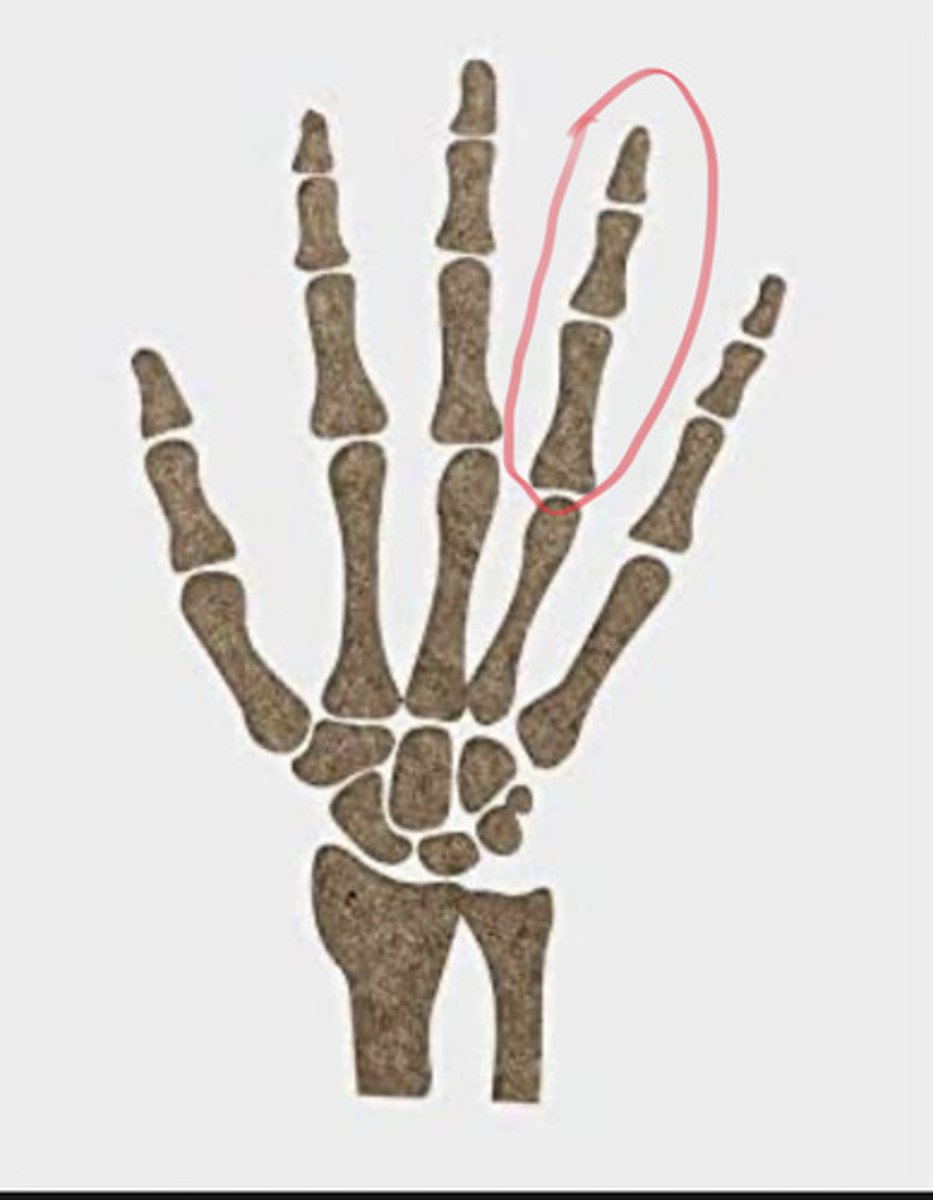 <p>fourth digit of the hand, fourth finger, or ring finger... the finger lateral to the little finger</p>