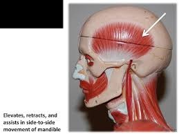 <p>What muscle is this?</p>