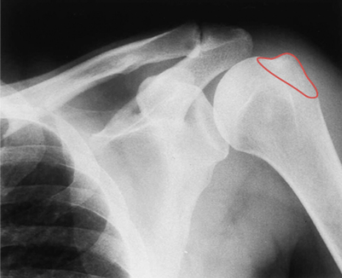 <p>What structure is highlighted?</p>