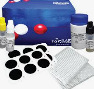 <p>Rapid-Latex Agglutination Test for D-Dimer</p>