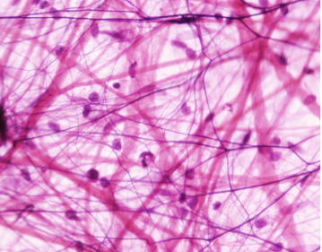 <p>Label the Areolar CT</p>