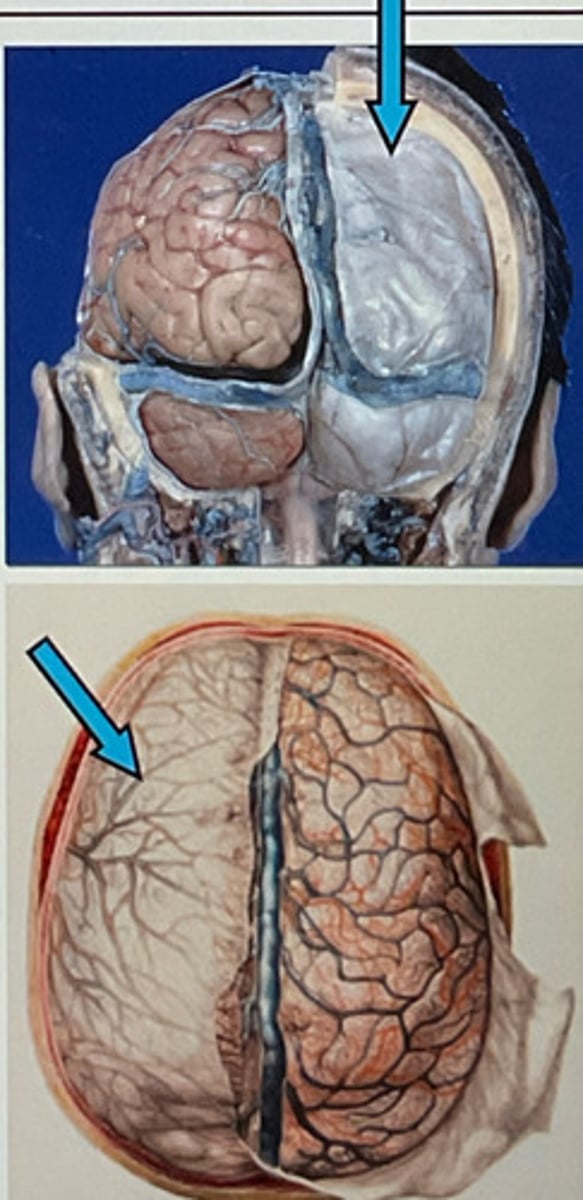 <p>thick, outermost layer of the meninges surrounding and protecting the brain and spinal cord</p>