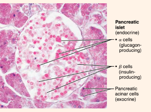 <p>What endocrine organ or gland is this?</p>