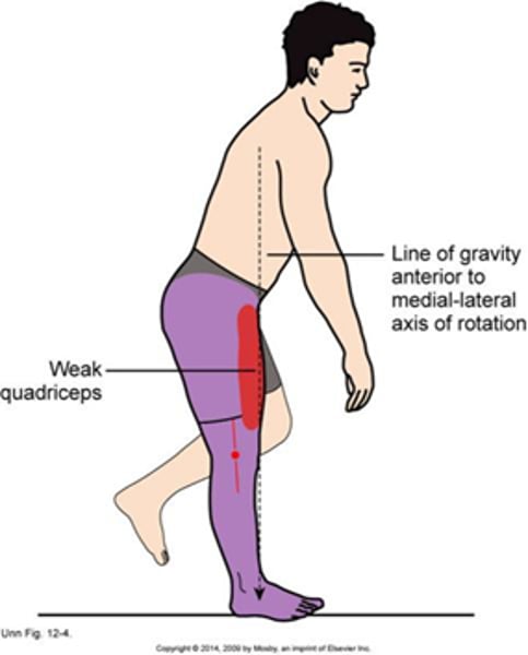 <p>•Excessive Anterior Trunk Bending to Compensate for Weak Quadriceps<br><br>•Weak quadriceps leading to anterior trunk lean to move the CoM of the body anterior to the axis of rotation of the knee</p>