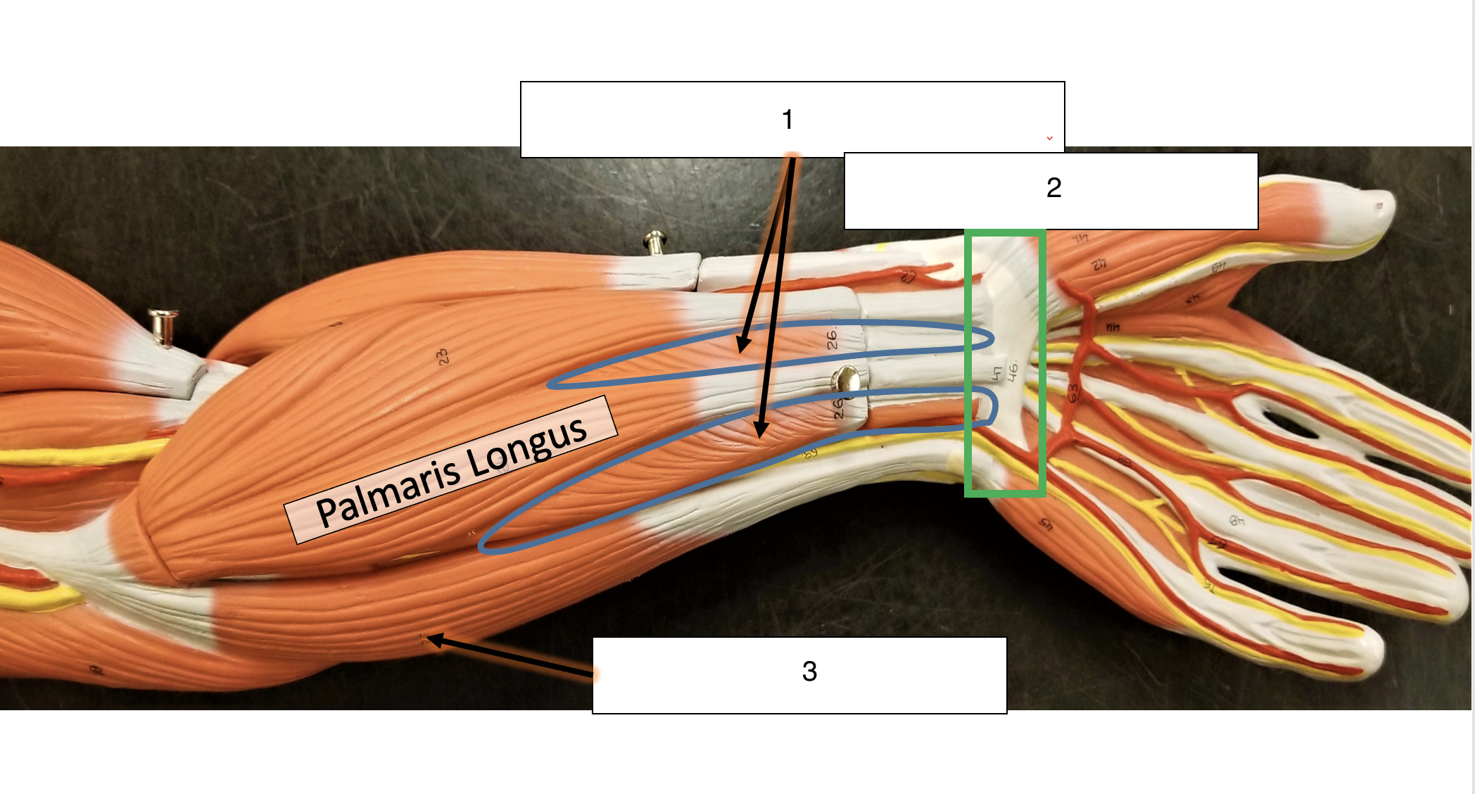 <p>name the muscle (3)</p>