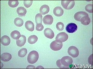 <p>Because Folate is needed for red blood cell synthesis, and when there is not enough folate, then the red blood cells grow larger and cell division cannot occur due to impairment of DNA synthesis.</p><p>These large cells never mature and they cannot carry oxygen correctly</p>