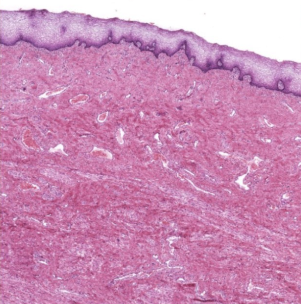 what is this a slide of 