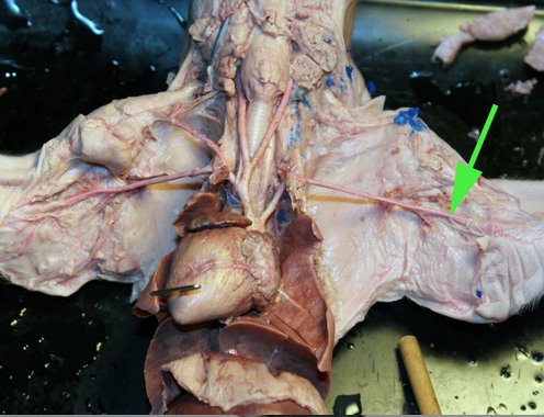 <p><span>The section of the artery marked by the green arrow is called the </span><strong>brachial artery</strong></p>