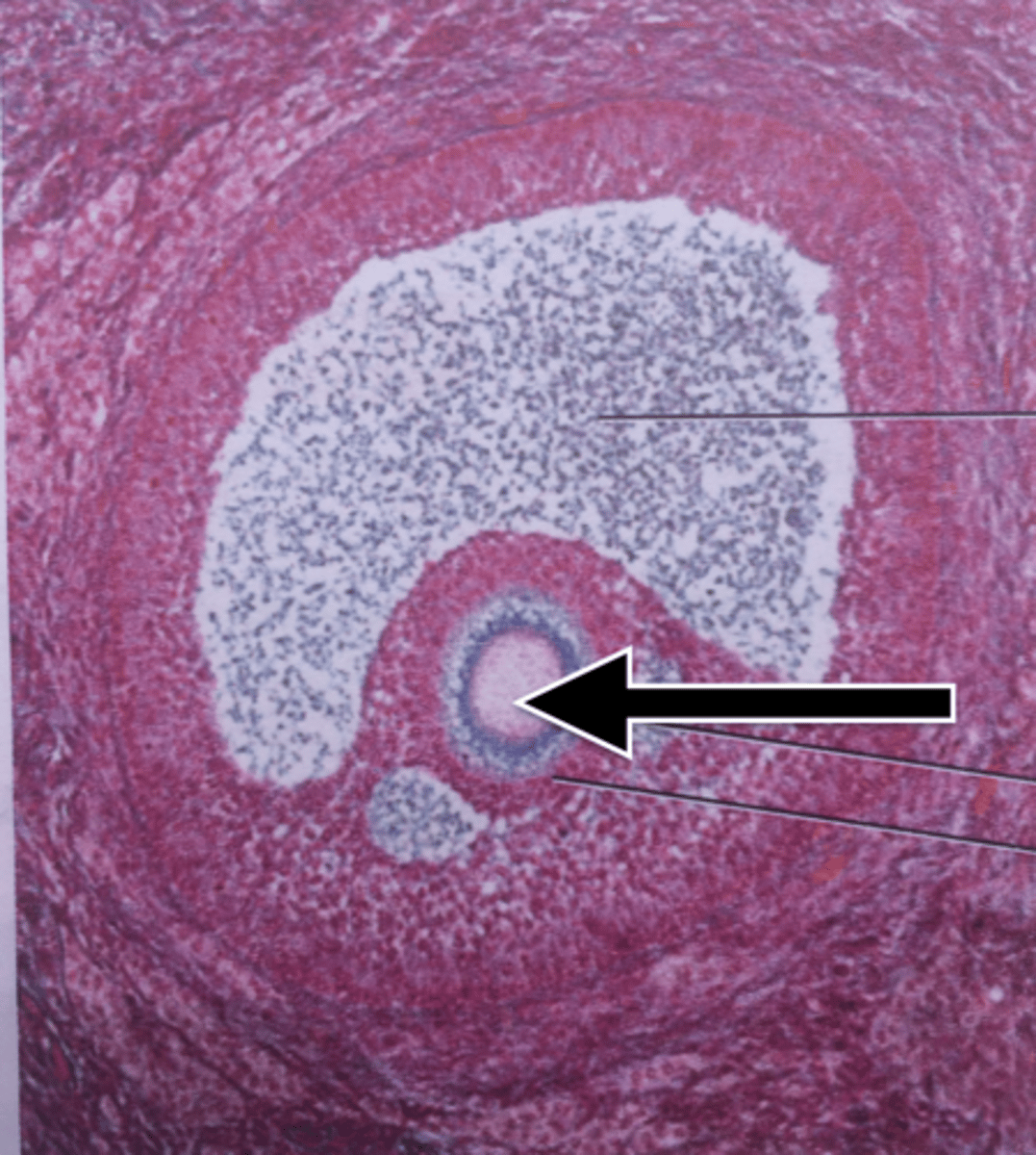 <p>An oocyte prior to completion of meiosis I.</p>