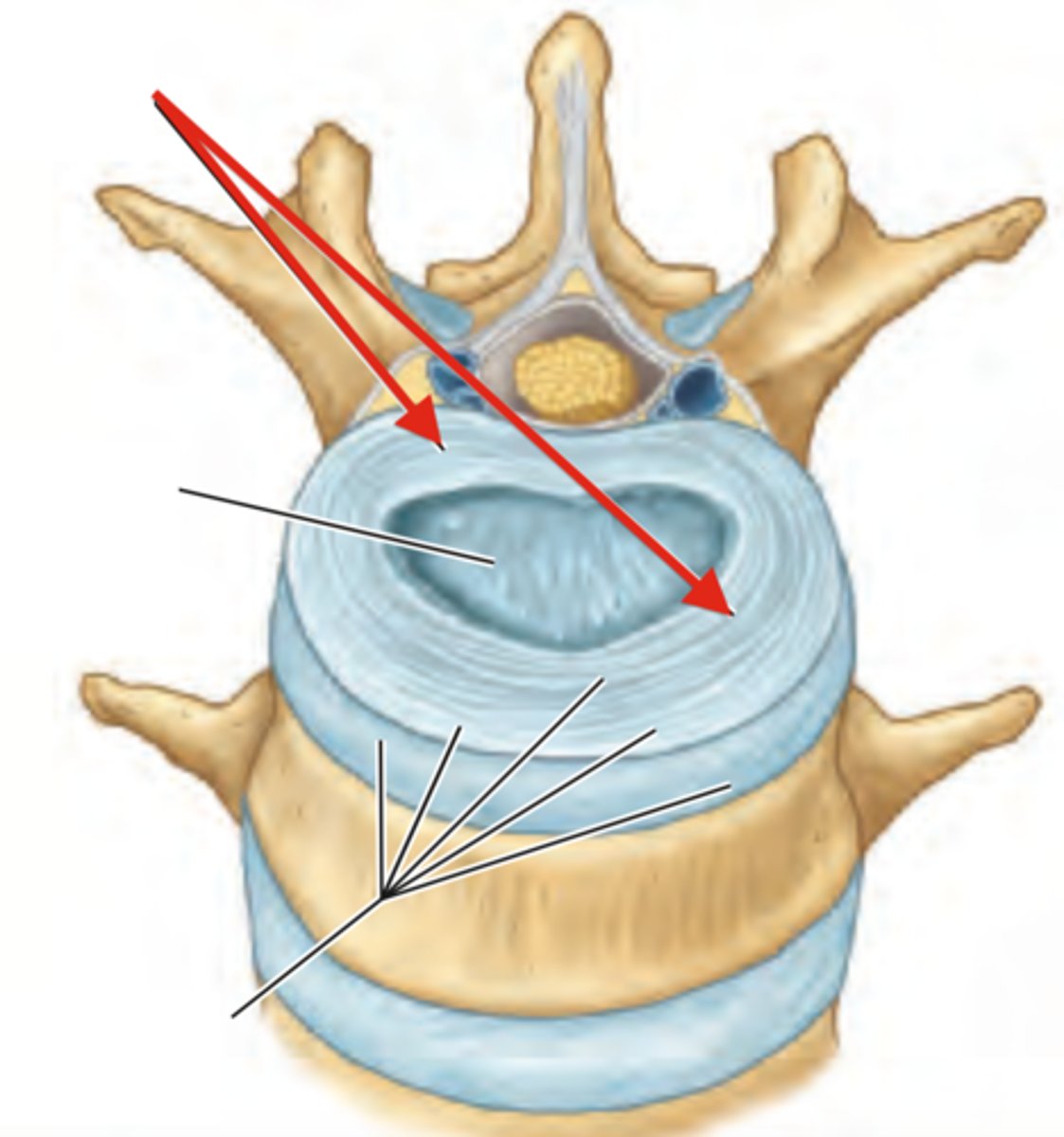 <p>This is the outer most ring of the intervertebral disc, it consists of a fibrocartilage lamellar configuration. These limit rotation of the vertebral joint.</p>