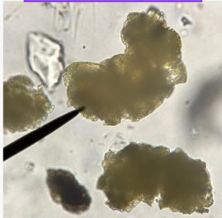 <p>This photo shows a wet mount of ____ _____.</p>