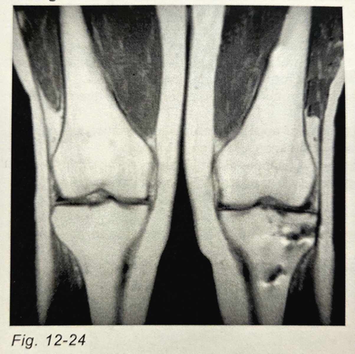 <p>Metal</p><p>3 multiple choice options</p>