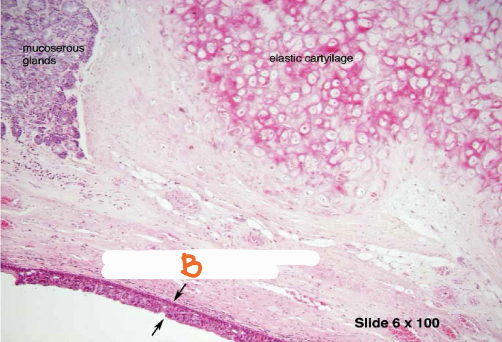 <p>Identify the structure and lining epithelium</p>