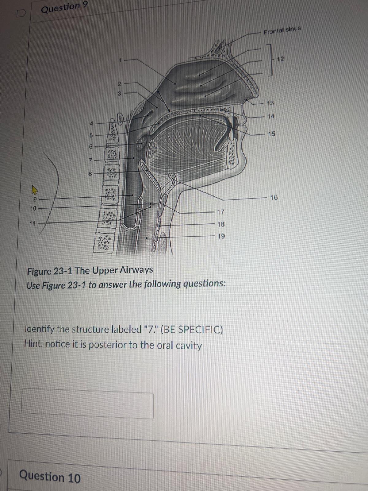 <p><span>Identify the structure labeled "7." (BE SPECIFIC) Hint: notice it is posterior to the oral cavity</span></p>