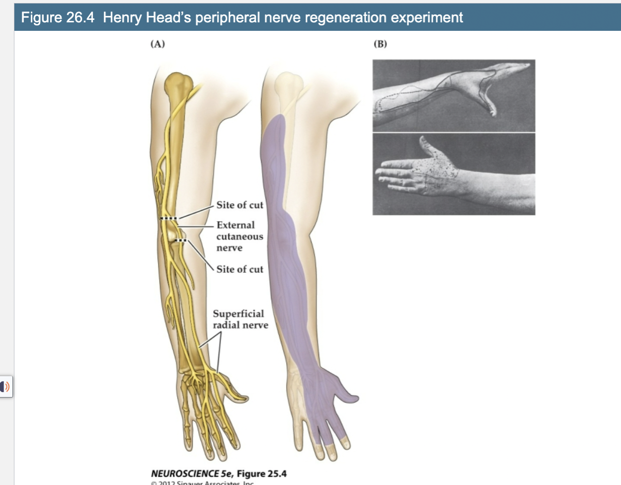 <p>Figure 26.4 Henry Head’s peripheral nerve regeneration experiment</p>