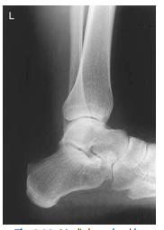 <p>What Ankle view is this?</p>