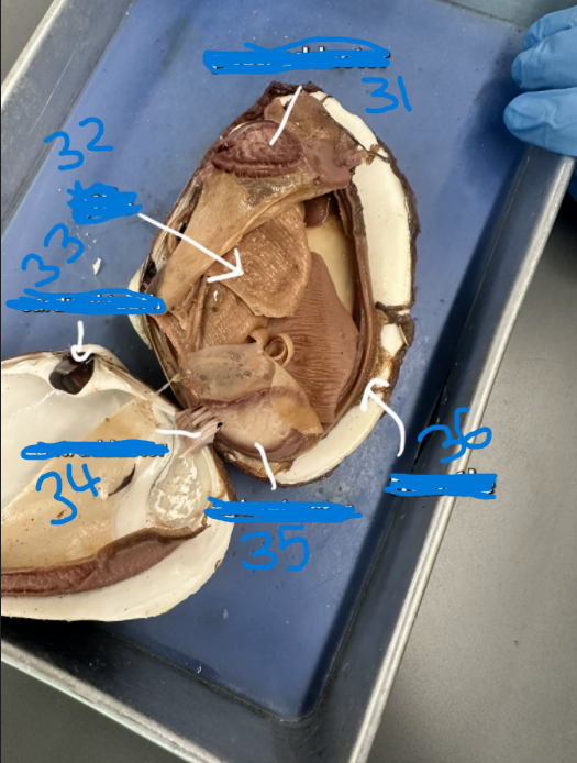 <p>What is option 32</p>