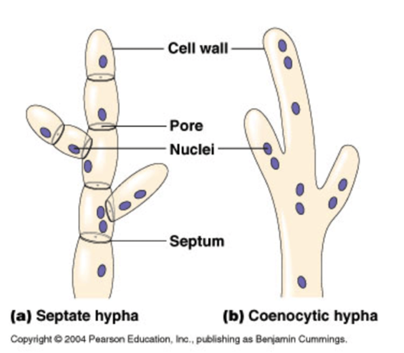 <p>Hyphae that are subdivided into individual cells by transverse walls.</p>