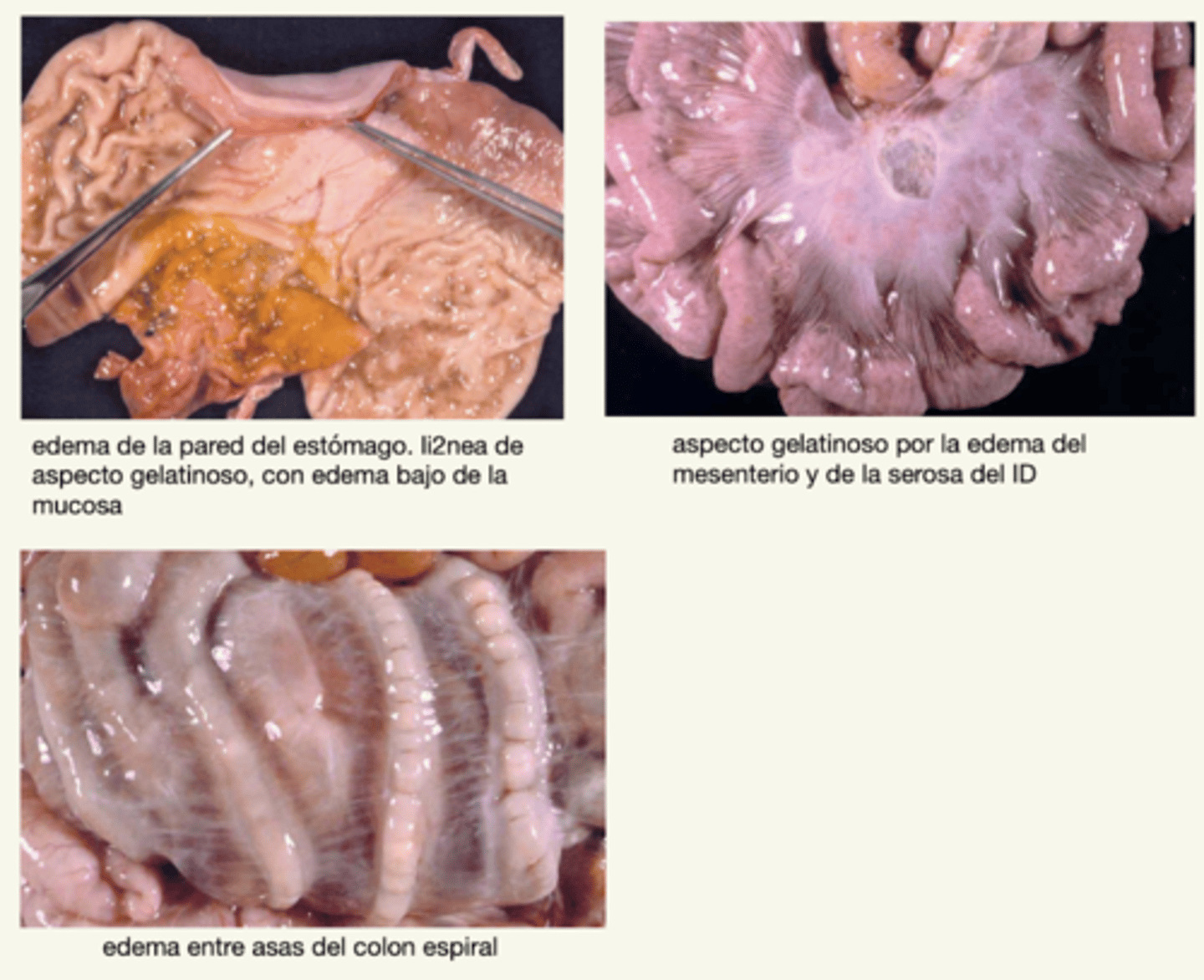 <p>- SC del estómago</p><p>- intestino</p><p>- mesenterio</p><p>- vesícula biliar</p><p>- linfonodos del mesenterio y colon</p>