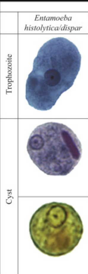 <p>Entamoeba moshkovskii</p>