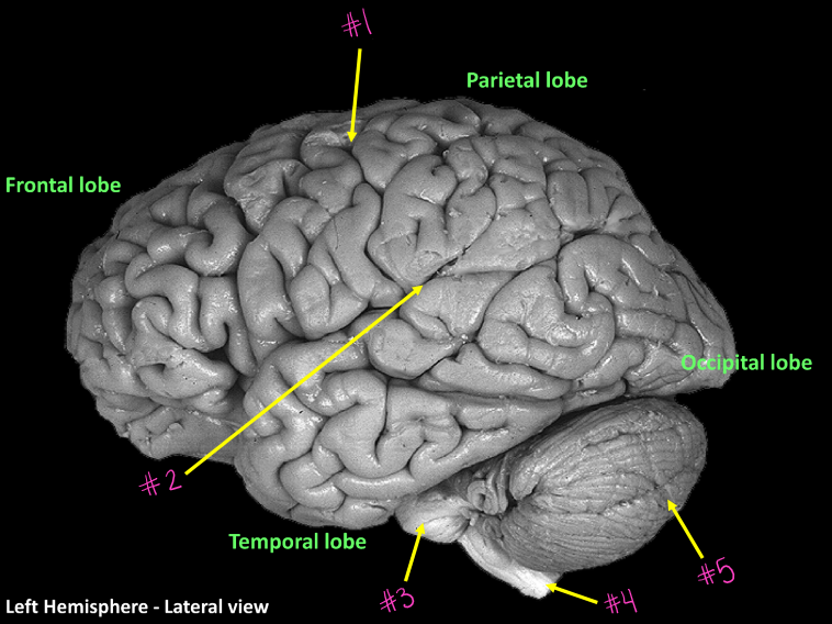 <p>What structure is #3</p>