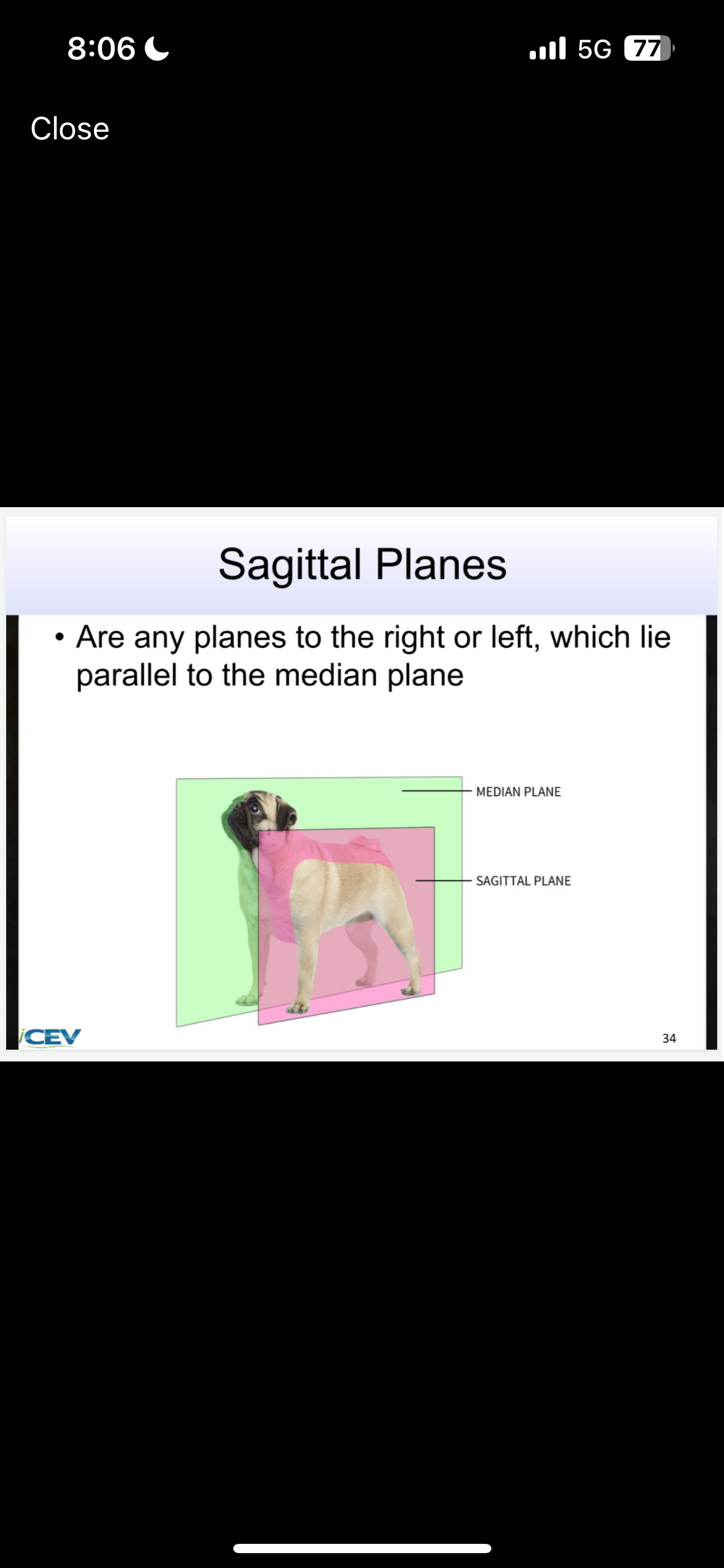 <p>Are any planes to the right or left, which lie parallel to the median plane</p>
