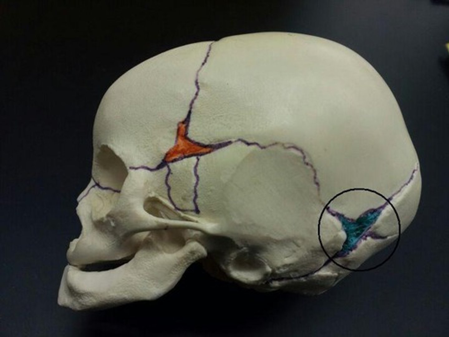 <p>Soft spot in the skull where membranes cover the space between bones</p>