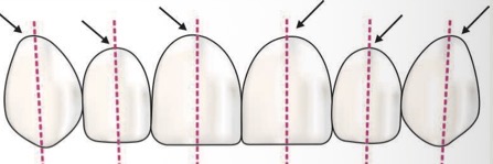 <p>most apical point of the gingival tissues along the long axis of the tooth</p>
