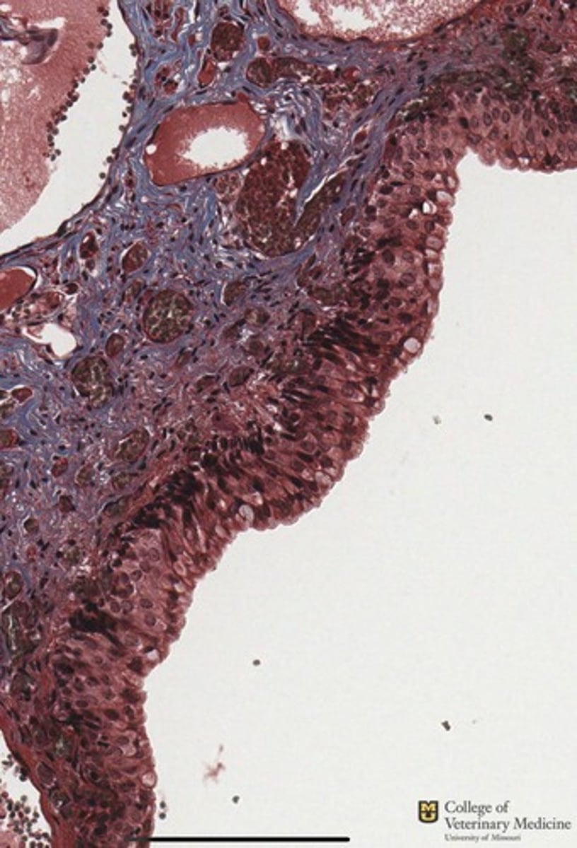 <p>What type of epithelium is shown?</p>
