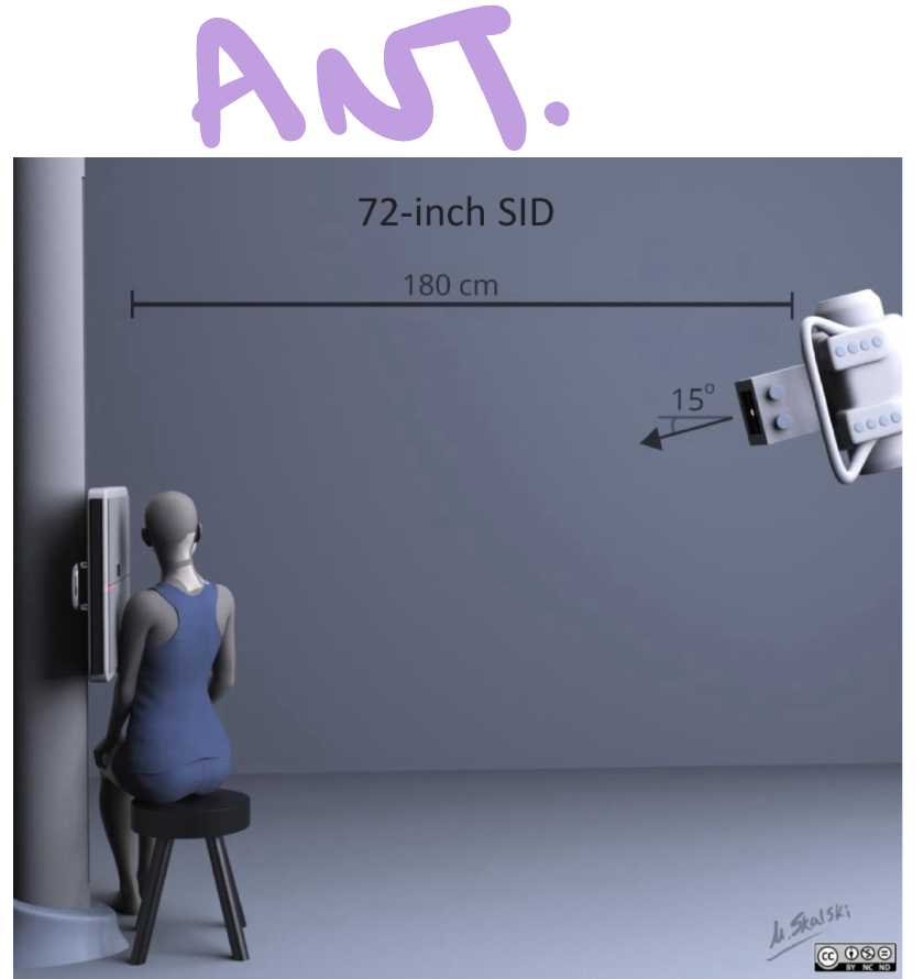 <p>SID: 72”</p><p>Air Gap: YES</p><p>Cassette Size: 10×12</p><p>Collimation: less than film size</p><p>Tube tilt: 15* CAUDAL (down)</p><p>Measure through: C7 level</p><p>Central ray: C4</p><p style="text-align: left">Breathing: suspend RESPIRATION</p><p style="text-align: left">*AO = SAME sided IVF</p><p style="text-align: left">*IVF = ASS POOP</p><p style="text-align: left">*don’t forget to seat pt</p>