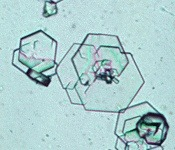 <p>Cystine crystals</p>