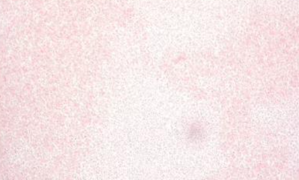 <p>Tiny Gram Negative Coccobacillus</p>