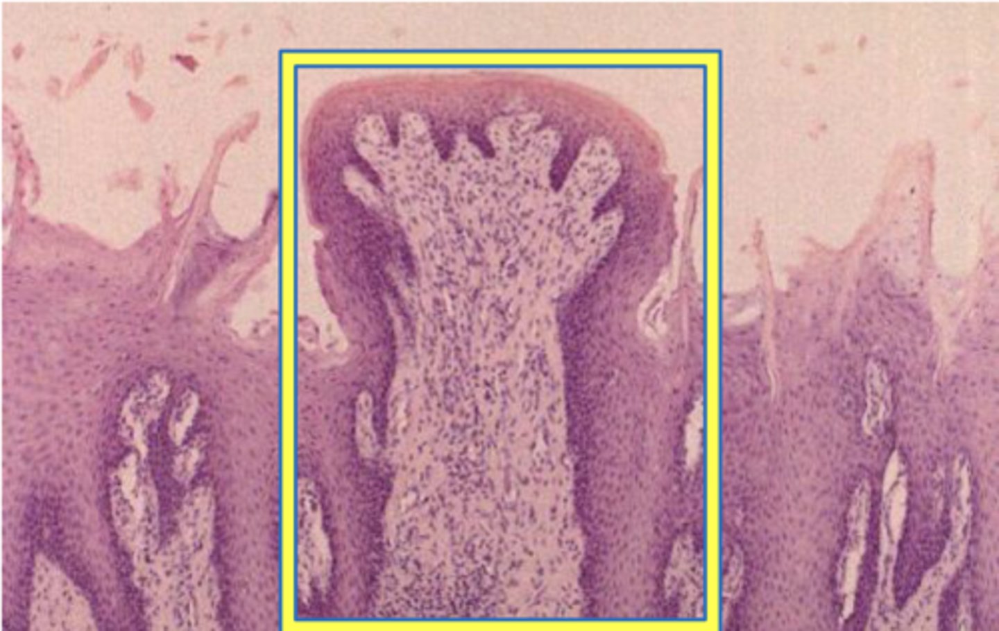 <p>shaped like mushrooms and are found at the tip and sides of the tongue; respond to texture</p>