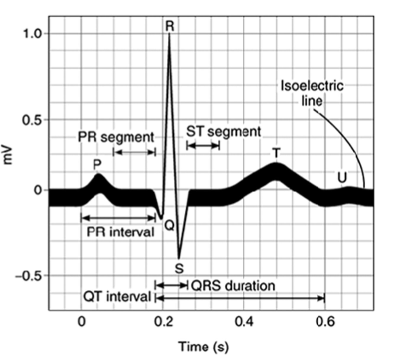 <p>Boxes measure time and distance</p>