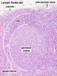 <p>The lymph nodes are</p><p>inverted with the germinal centers being located in the</p><p>internal portion of the node.</p>