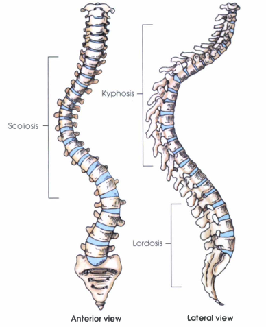 <p>Abnormal Curvatures</p>