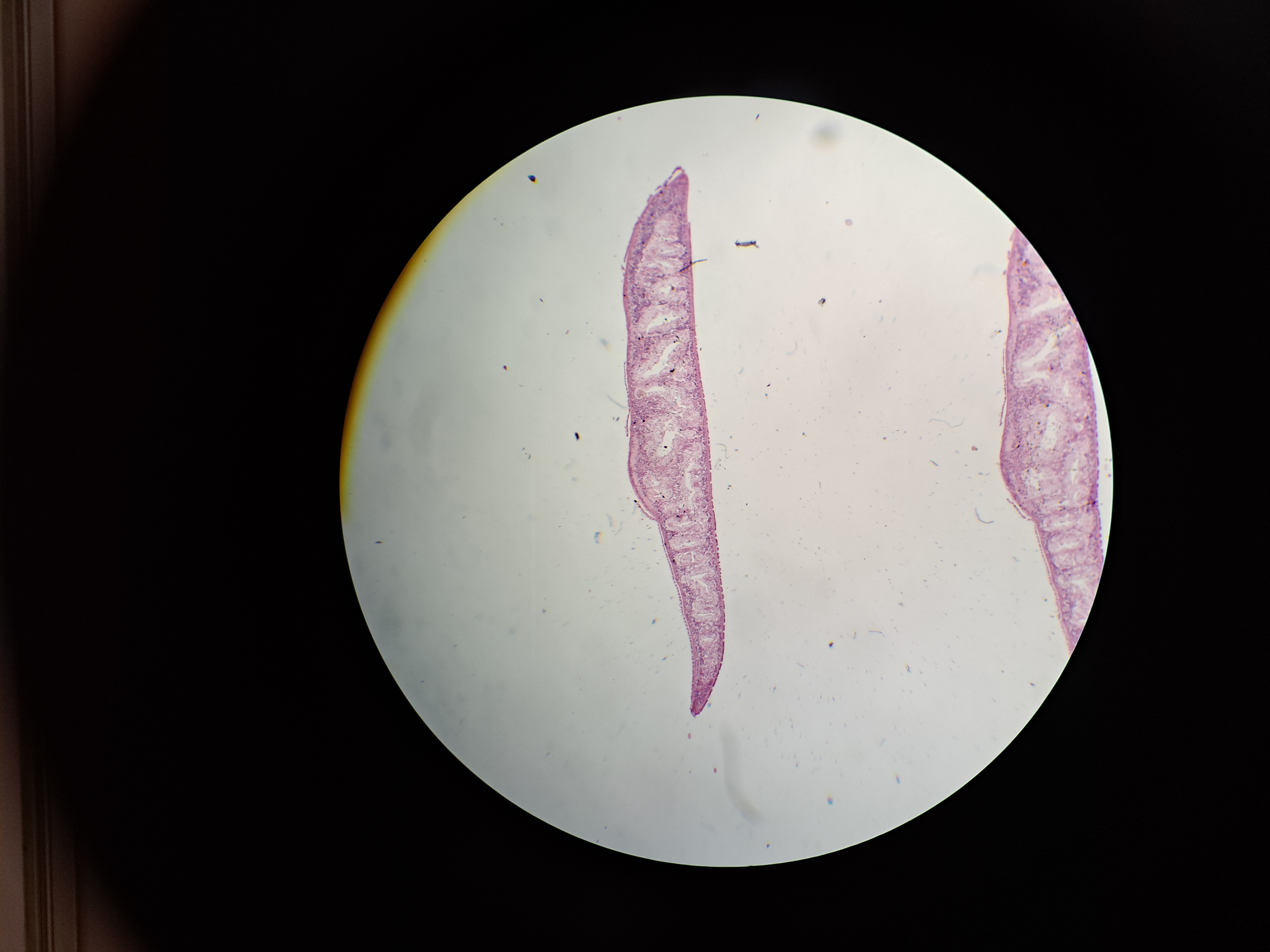 <p>kmen: PLATYHELMINTHES (ploštěnci)</p>