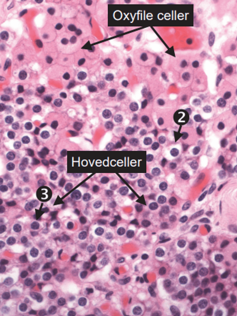 <p>Hovedceller og oxyfile celler</p>