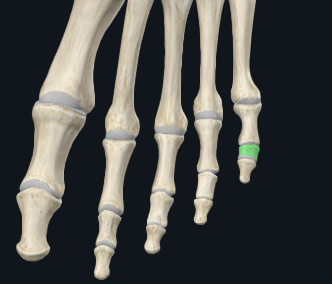 <p>What bone is this (general)</p>