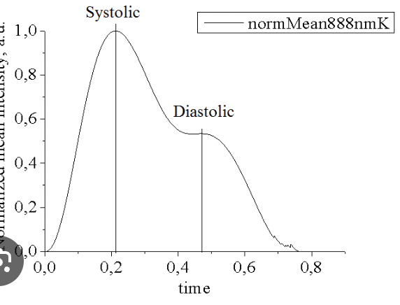 <p>Portion of the cardiac cycle where the ventricles are relaxing </p>