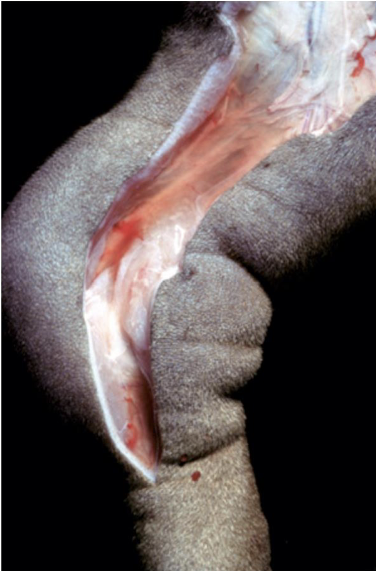 <p>In congenital lymphoma, the lymphatic vessels are either ________ or ________.</p>