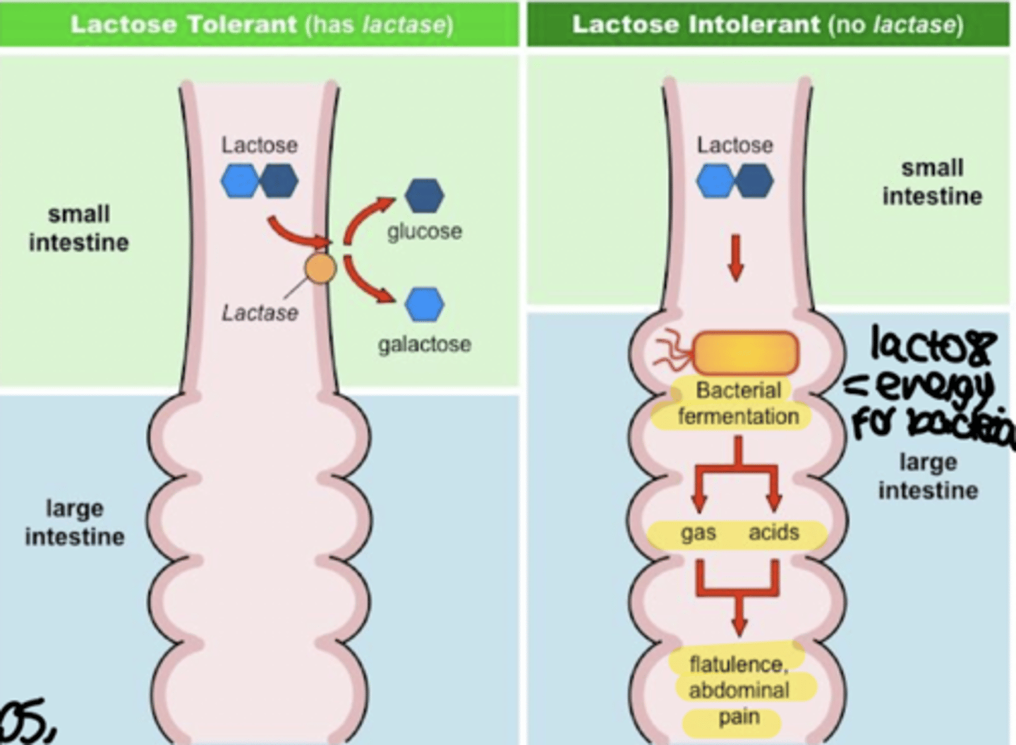 <p>• Hypolactasia causes no disturbance unless lactose-containing food is consumed and activity of remaining enzyme is overwhelmed</p><p>• If lactose is delivered to the colon from the ileum colonic microflora produce:</p><p>• Short-chain fatty acids (which can be absorbed)</p><p>• Hydrogen (H2- which can be detected in the breath of lactase deficient individuals following a lactose challenge)</p><p>• Carbon dioxide</p><p>• Methane</p>