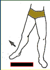 <p>What Movement is occurring?</p>