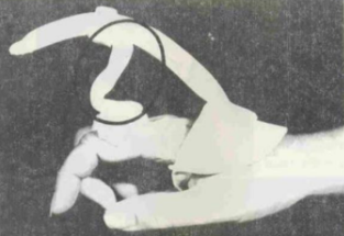 <p>Name this static splint component. What’s its function?</p>