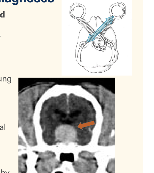 <p>Blindness <strong>without PLRs Differential diagnoses</strong></p>